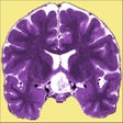 Icon of program: Neuro Toolkit