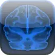 Icon of program: Brain Scan!