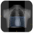 Icono de programa: CT Scan Technique