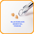 Icono de programa: Remove Blackheads Videos