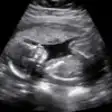 Icon of program: Baby Ultrasound 2015