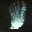 Icono de programa: Xray Scanner