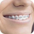 Icon of program: Teeth Braces Photo Maker-…