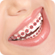 Icono de programa: Braces Photo