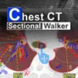 Icon of program: Chest CT Sectional Walker