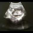 Icono de programa: Full Term - Contraction T…