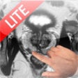 Icon of program: Prostate Cancer Imaging L…
